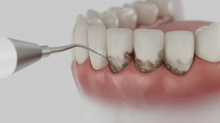 Reliable Dental Implants contractor in Clarksville, TX by Smile Center Dentistry